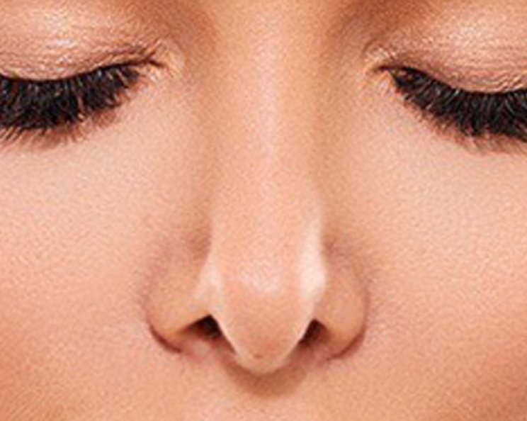 lipolifting